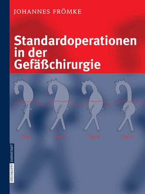 cover image of Standardoperationen in der Gefäßchirurgie